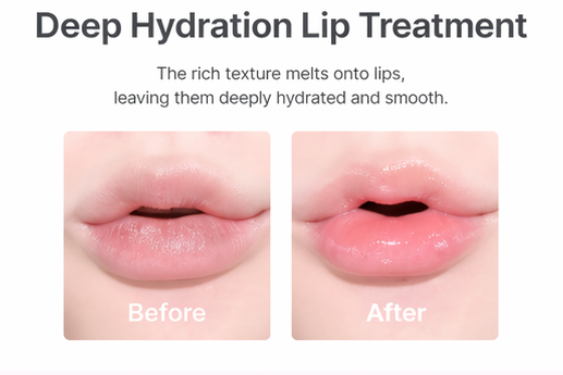 deep hydration lip treatment